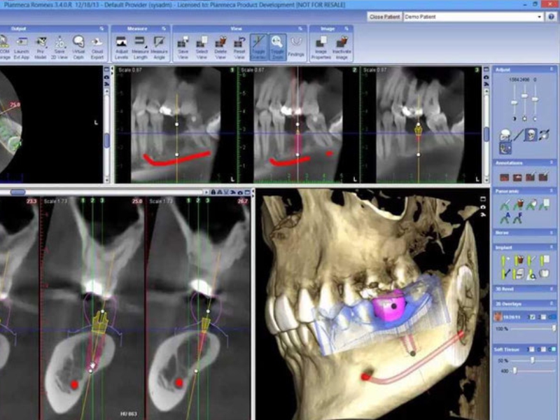 Sanat-implantes-dentales Sanart Odontología Integral - Odontología Integral